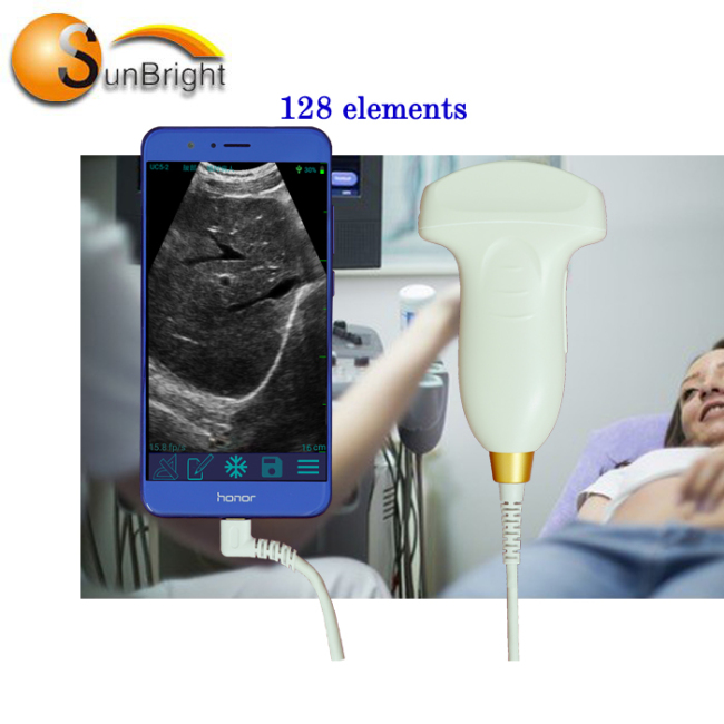 128 Elements wireless Wi-Fi ultrasound USB Probe IOS Android Mobile Device