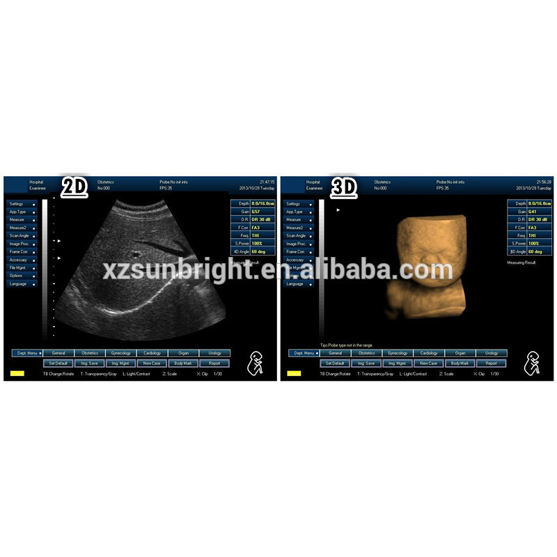 similar with medison ultrasound laptop 3D digital scanner