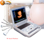 New promotion portable electric USB type ultrasound machine with win 7 system
