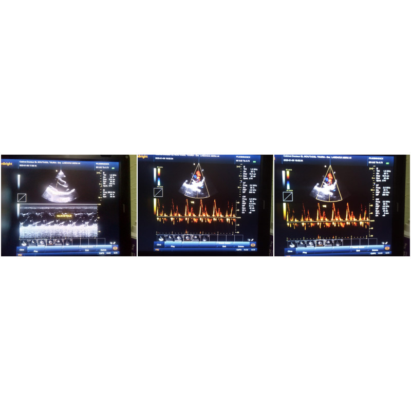 128 elements good quality color doppler ultrasound facotry sale 4D color doppler ultrasound instrument equipment