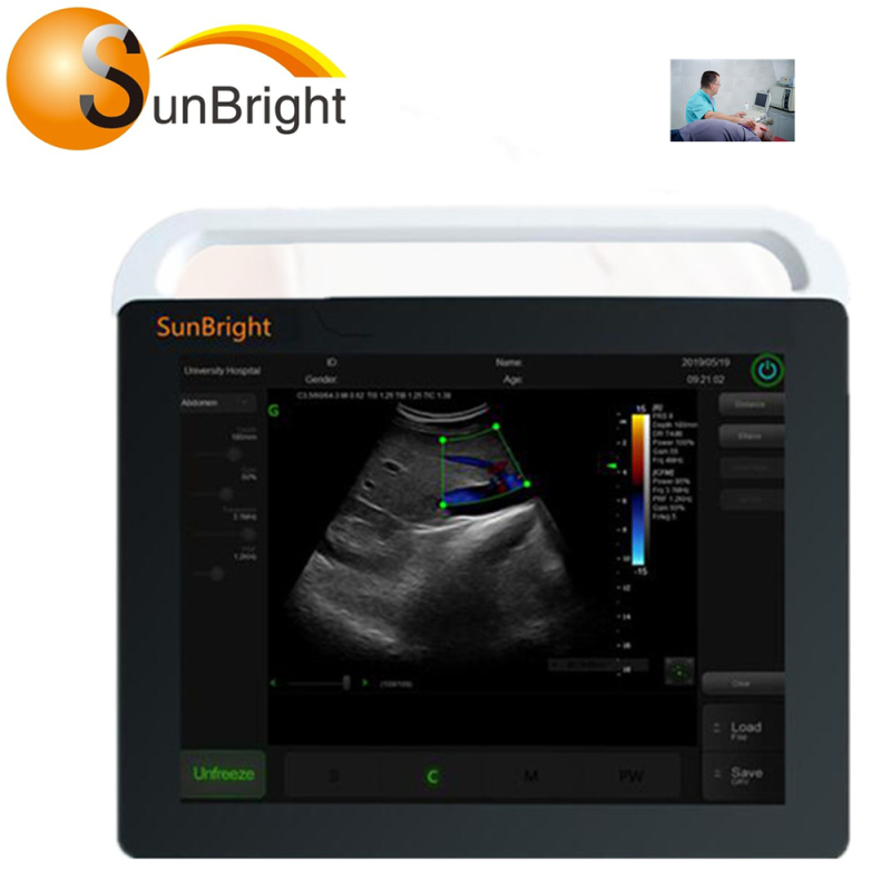 수의학용 소 초음파 장비를 위한 선명한 이미지 스캔