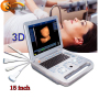 High resolution clear images Ecograph Laptop notebook Portable Color Ultrasound Machine