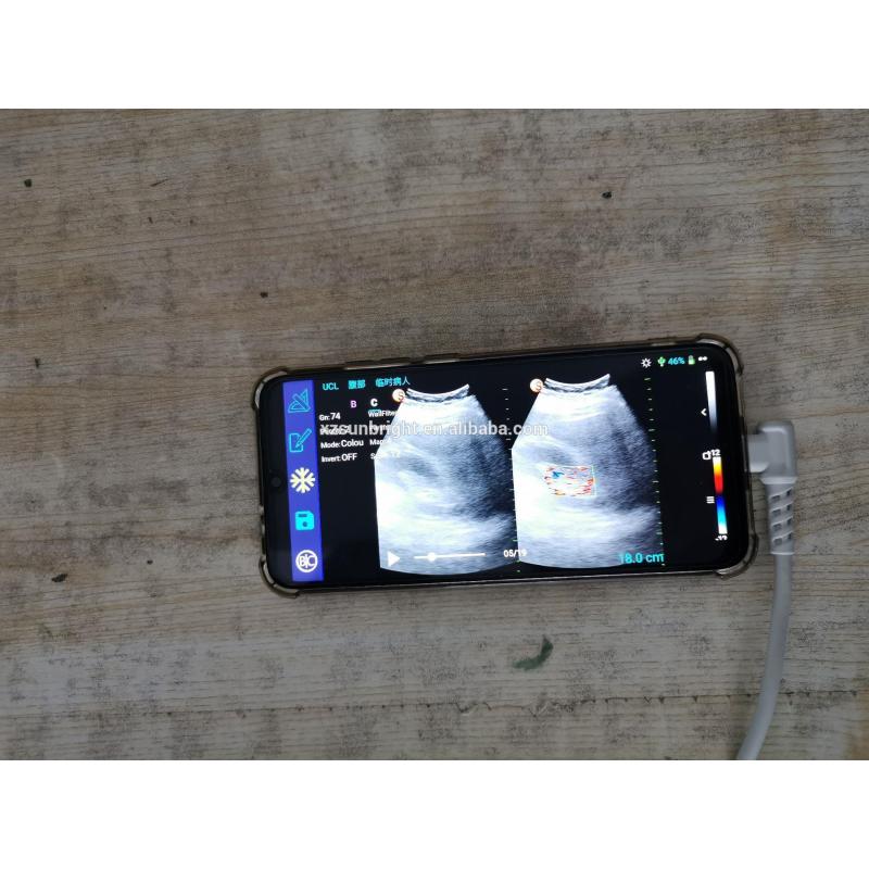 새로운 듀얼 헤드 공장 가격 초음파 초음파 USB 볼록 프로브 SUN-D3