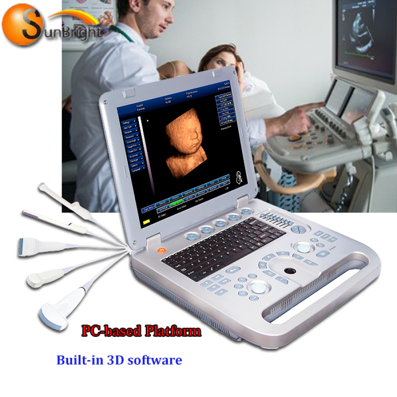 수의사 초음파 시스템 3D 노트북 의료 장비
