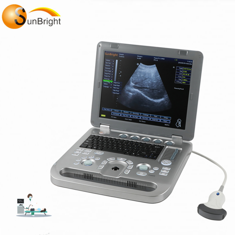 Tragbarer, erschwinglicher medizinischer 3D-Scan lebendiger e9-Ultraschall