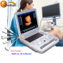 High end Echography laptop 3D pregnancy scanner portable ultrasound machine scanner