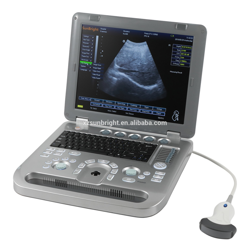 Echo price echographe high quality portable color sonography vascular ultrasound with linear probe