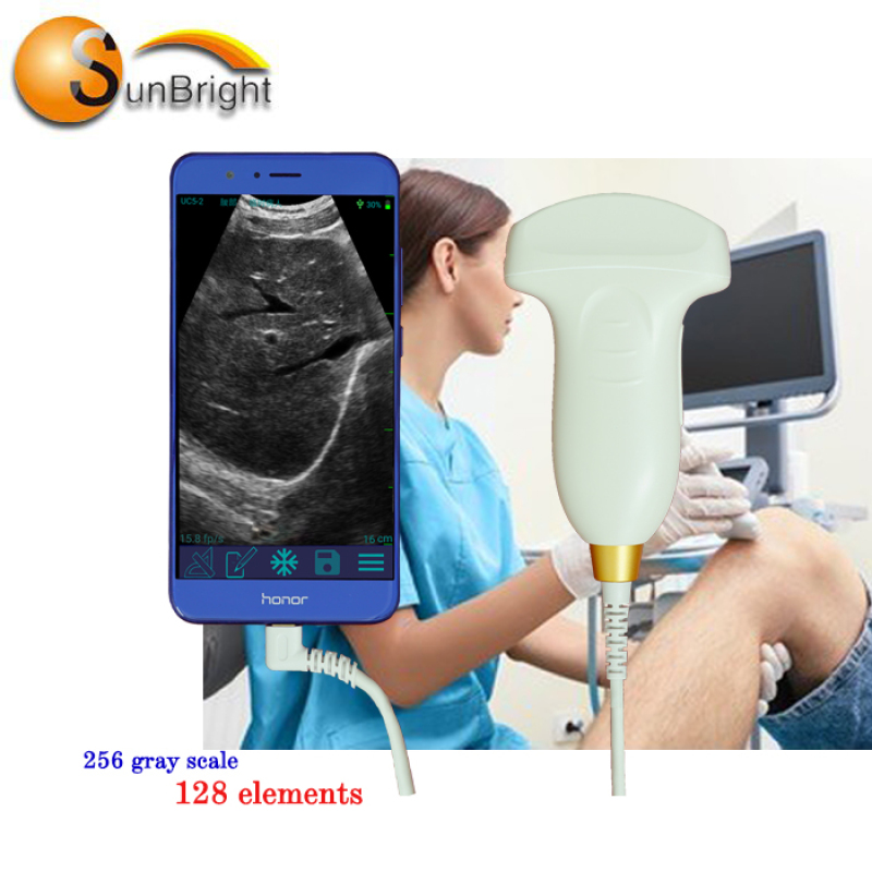 ماسح ضوئي متقدم عالي الدقة بمسبار USB ملون بالموجات فوق الصوتية دوبلر