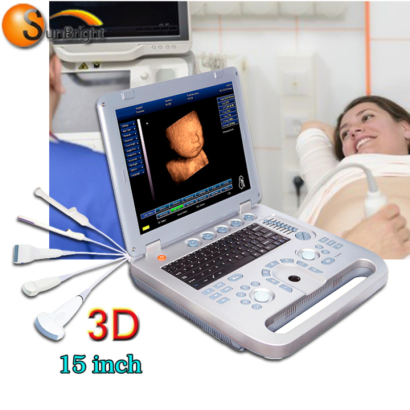 OB GYN Abdominal laptop clinic ultrasound stand machine
