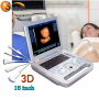 OB GYN Abdominal laptop clinic ultrasound stand machine
