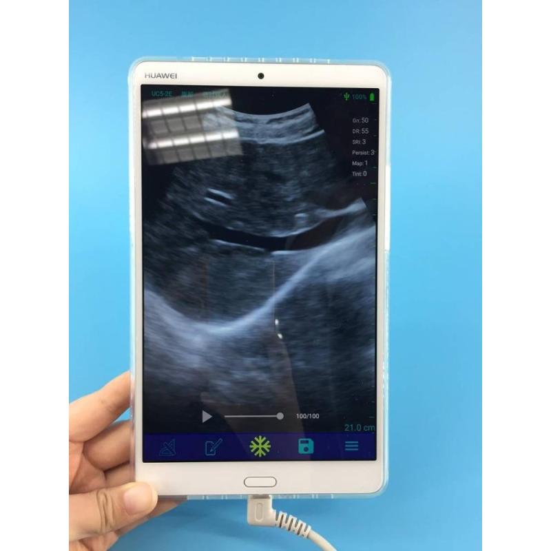 노트북, 소형 초음파 장치를 위한 소형 소형 ecografo USB 볼록한 초음파 조사