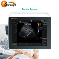wireless hand ultrasound convex probe Clinic use portable medical ultrasound