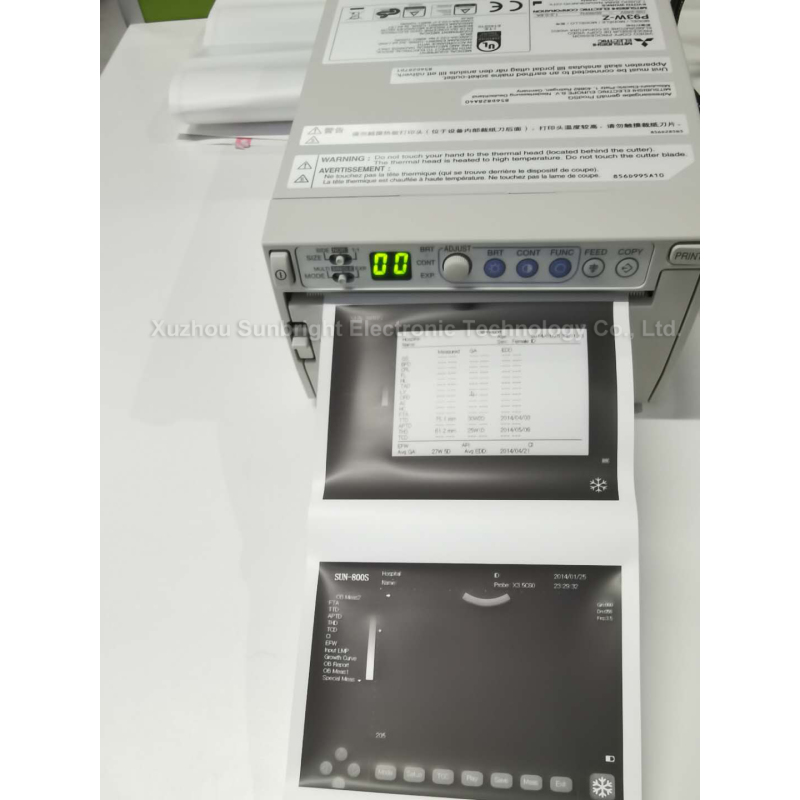 Scanner à ultrasons vétérinaire, tablette portable, meilleure vente, prix de la machine