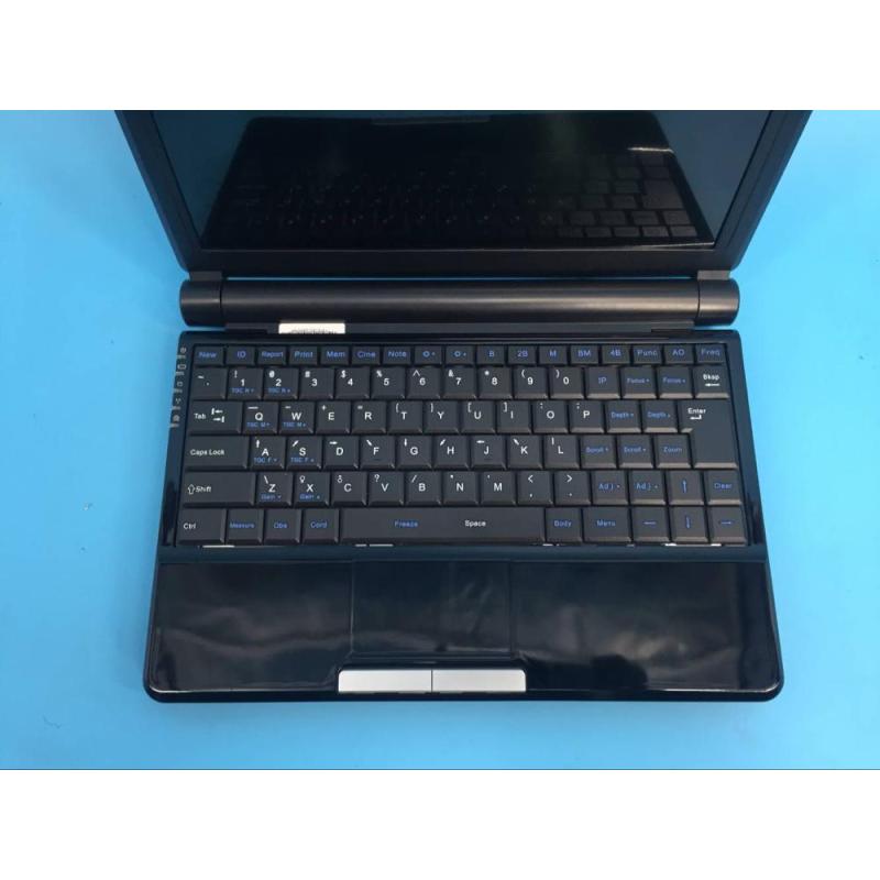 Hot sale! Medical ultrasound machine B W MINI laptop ultrasound diagnostic equipment