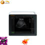 Portable laptop Gynecology obstetrics examination ultrasound machine price