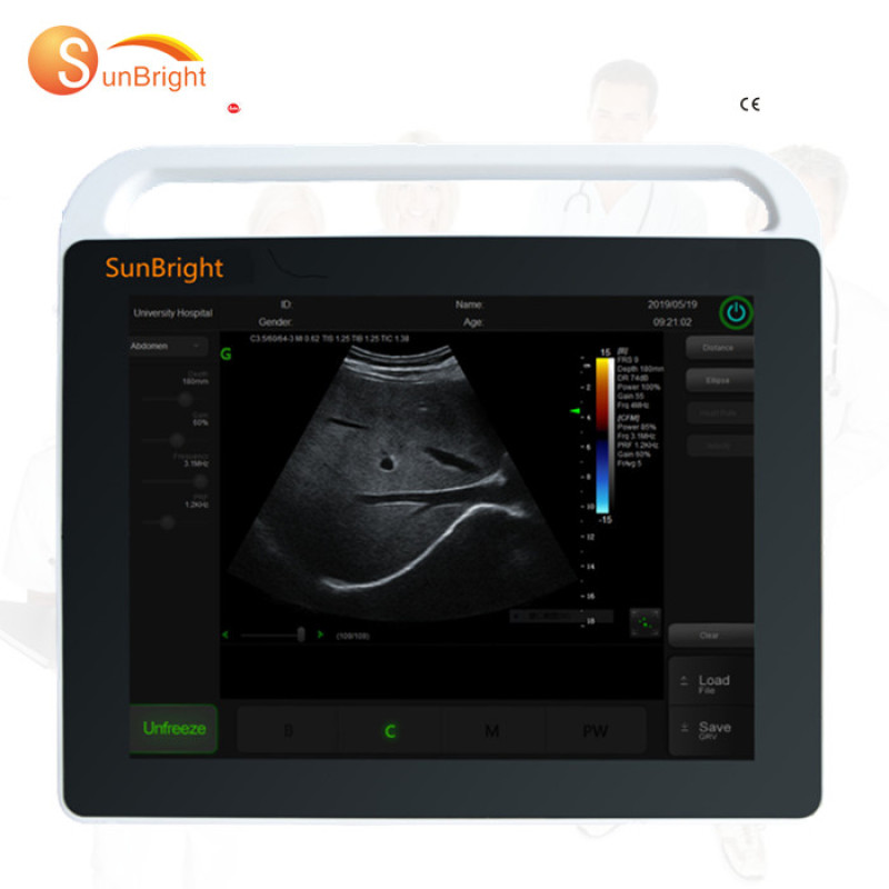 new type touch screen ecograph best ultrasound machine mulltifunctional ultrasound device