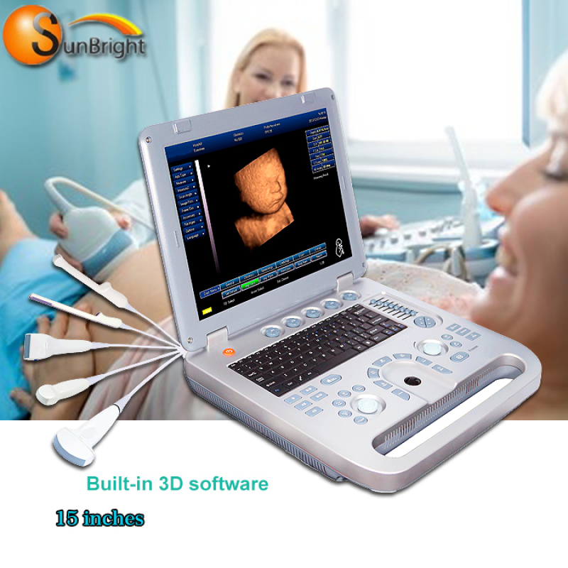 Portable Laptop 3D/4D Gynecology Ultrasound Color Machine SUN-800D