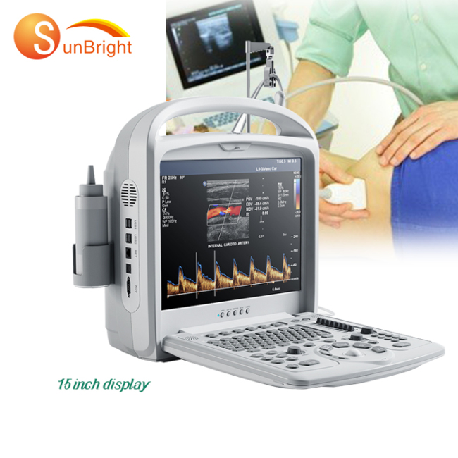good quality high performance clinical portable black white ultrasound trolley 3 probe machine