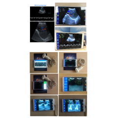 2020 product ideas convex android ultrasound probe diagnostic system for sale