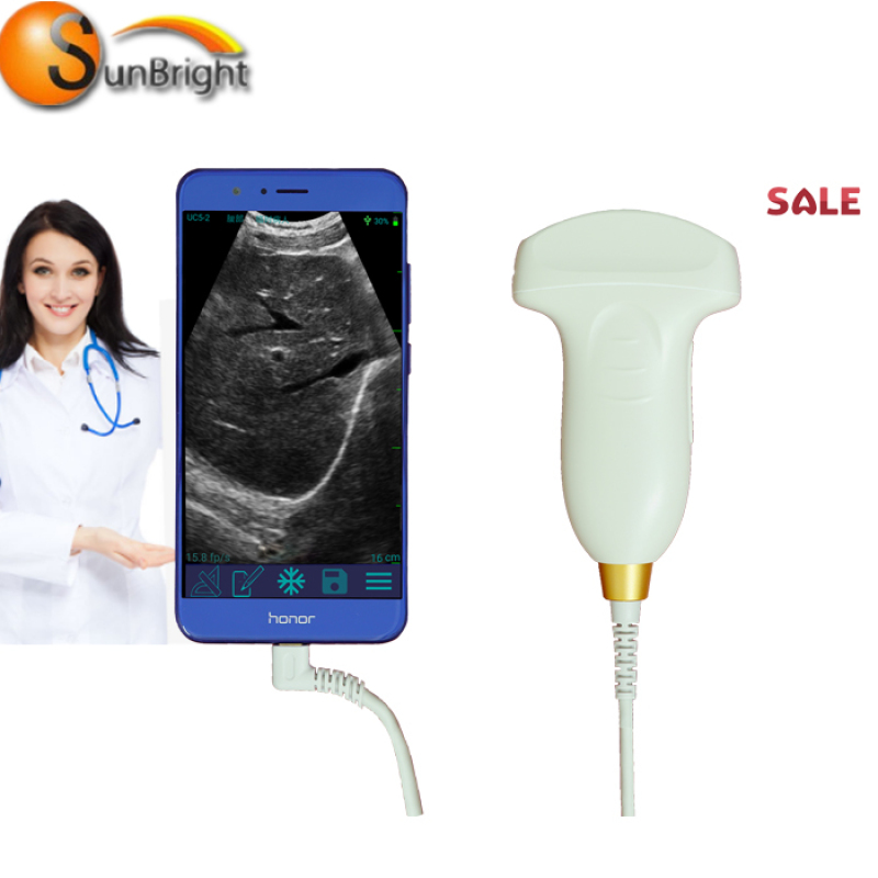 Factory price Portable ultrasound USB Convex Probe wireless ultrasound machine for sale