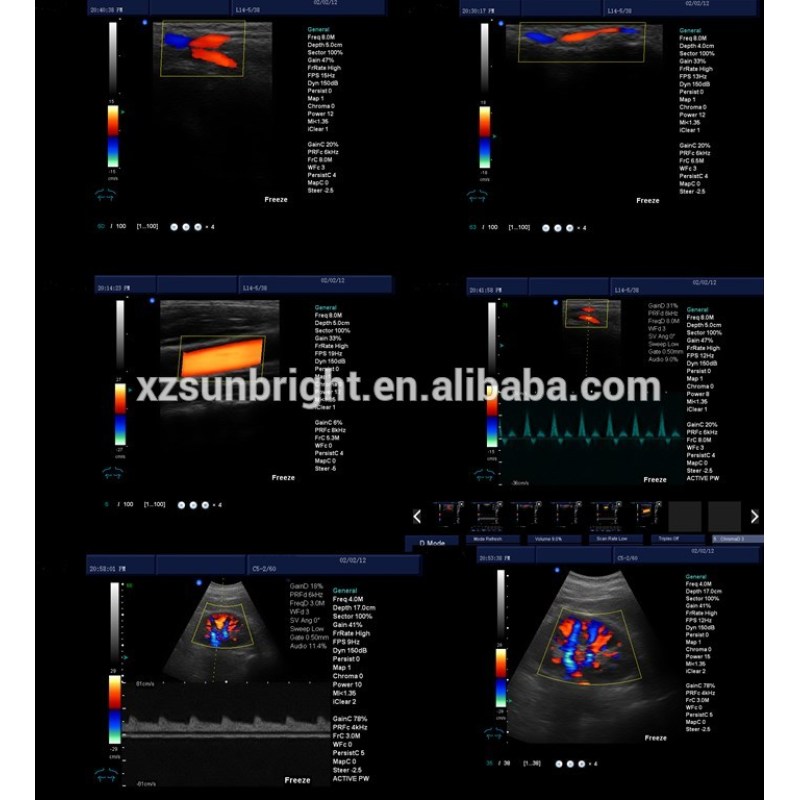 High imaging quality 3D 4D trolley diagnosis 4d system color doppler ultrasound machine