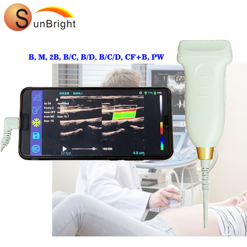 수의학 직장 프로브 128 요소 PW 기능 선형 프로브 USB 컬러 도플러 프로브 가격