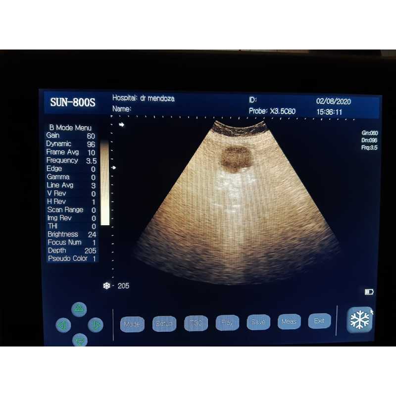 Портативний ветеринарний ч/б ехоапарат Sunbright Sun-800s найдешевший портативний ветеринарний УЗД