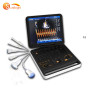 Máquina ultrasónica de ultrasonido doppler a color 3d Ultrasonido doppler portátil a color Ecografías de ultrasonido Doppler sonoscape 4d