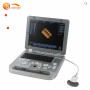 Système d'échographie médicale portable 3D le plus vendu