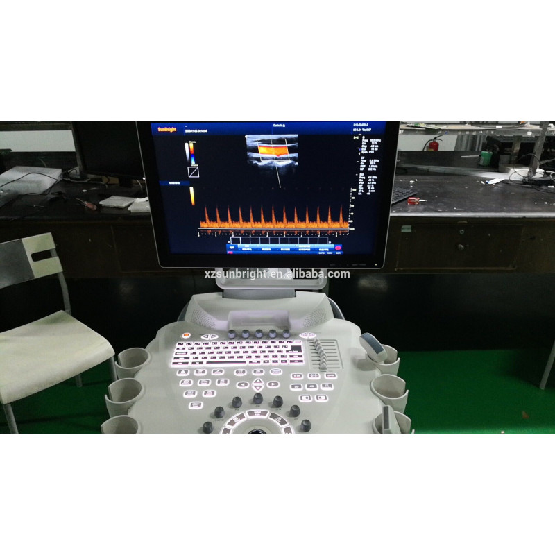 도플러 4d 트롤리 컬러 도플러 초음파 트롤리 카트 초음파 컬러 도플러 vscan 듀얼 스크린 기계