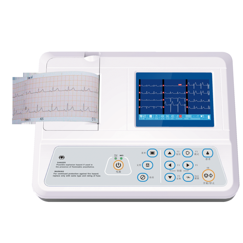 high performance digital one channel ekg 12 lead portable mobile best ecg machine