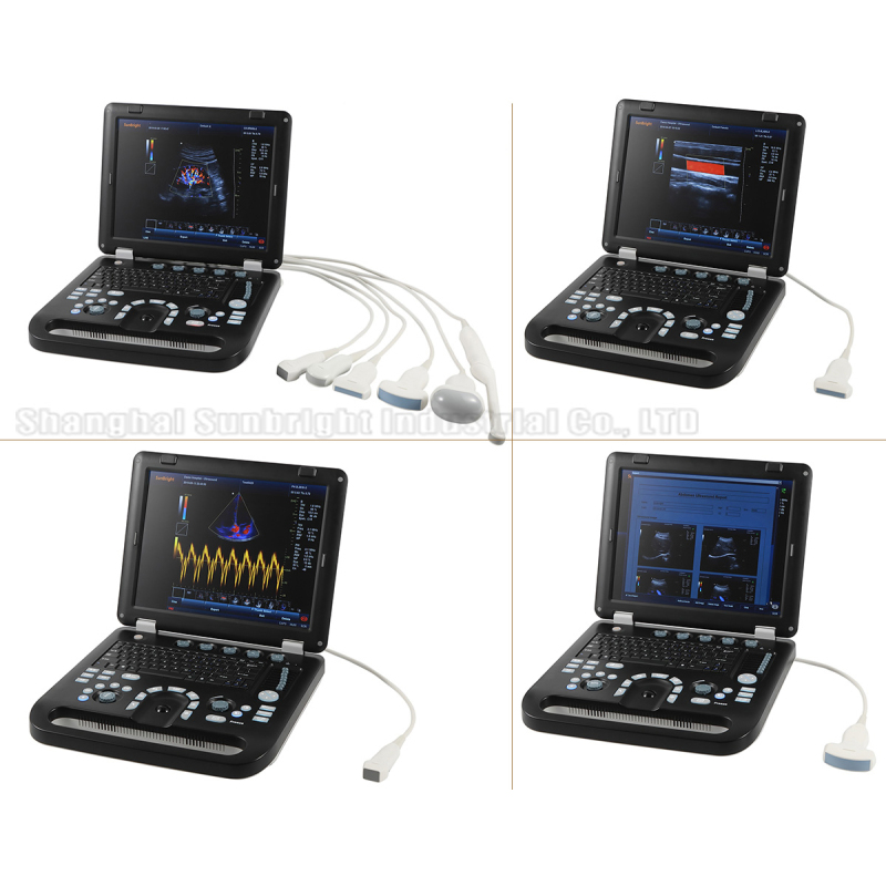 Portable high performance medical 3D 4D CW color doppler ultrasound SUN 906A