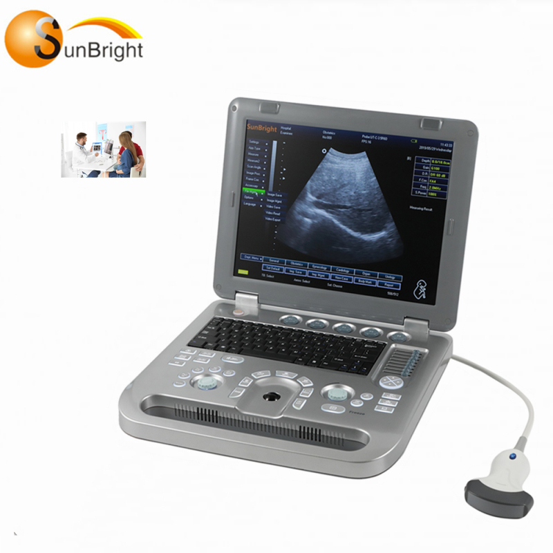 Hospital use scan fetal 3d ultrasound machine price hot sale