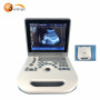 Nice appearance laptop notebook cheap price ultrasound machine for OB GYN Urology