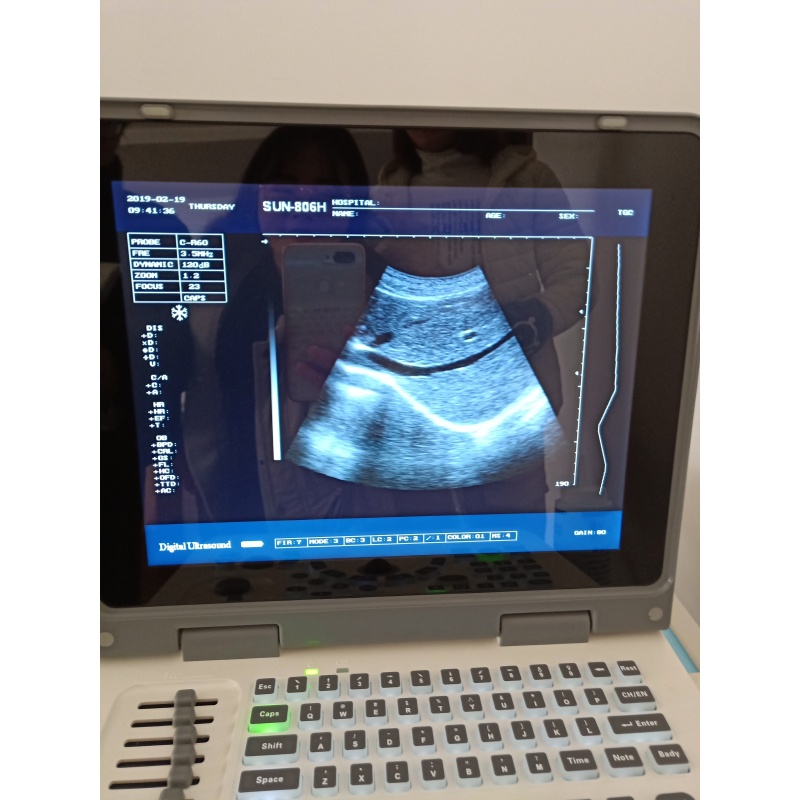 12.1 inches LED display sunbright laptop ultrasound scanner