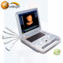 New upgrade color screen Obstetrics Gynecology 3D laptop ultrasound scanner