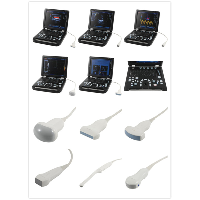 Portable 3D Color doppler ultrasound machine cardiac probe color Doppler cheap medical ultrasound instruments