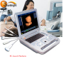 High resolution 3D portable gynecology ultrasound medical device