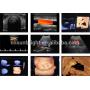 Portable 15 inch 3d 4d doppler ultrasound OB GYN color doppler imaging system