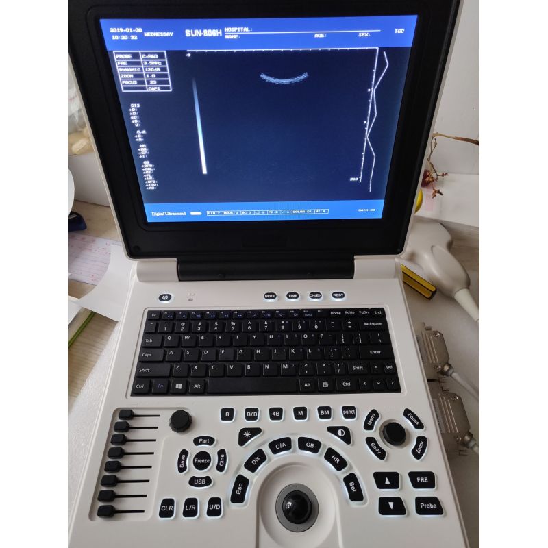 Black and White 2D medical portable laptop ultrasound scanner machine price