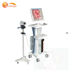 digital colposcope gynecology equipment Colposcope full HD camera digital colposcopy scancer