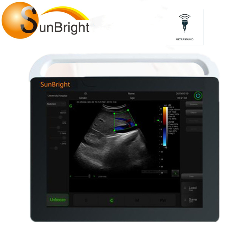 Hot sale cheap touch screen ultrasound machine Sunbright manufacture