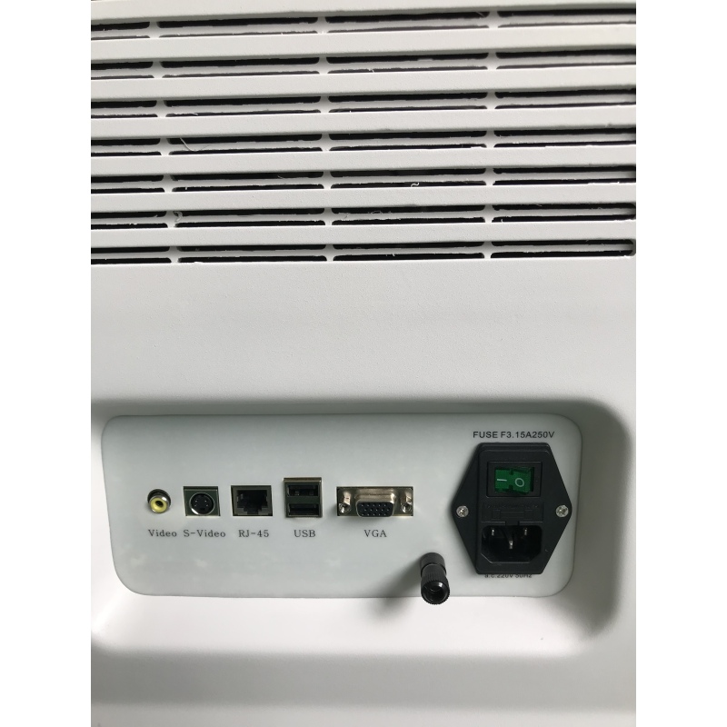 High resolution 22 inch display best trolley 3d/4d color Doppler sunbright digital portable ultrasound