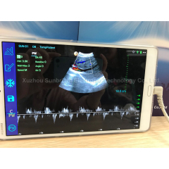 192 elements Android windows ipad ultrasound scanner wireless color doppler ultrasound probe