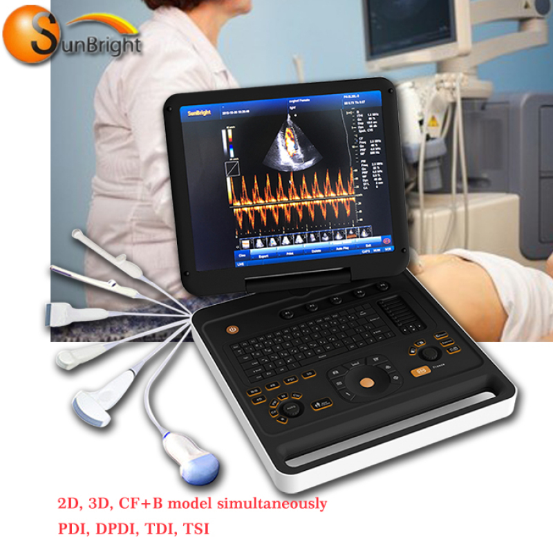 Module de capteur Doppler 15 pouces Image améliorée Échographie Doppler couleur Échographe portable