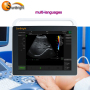 High Resolution LED 15 Inch Touch Screen sonoscape color Doppler ultrasound Echocardiography