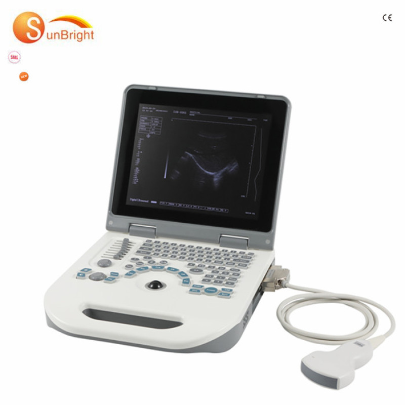 laptop 12 inches ultrasound diagnostic system machine 3d ultrasound machine cost