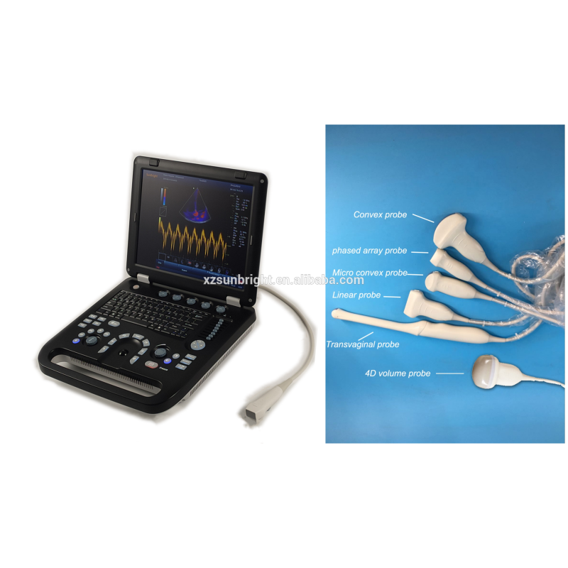 OB Urology Gynecology Digital Color Doppler Diagnostic ultrasonido 4d ecografo portatil ginecologico