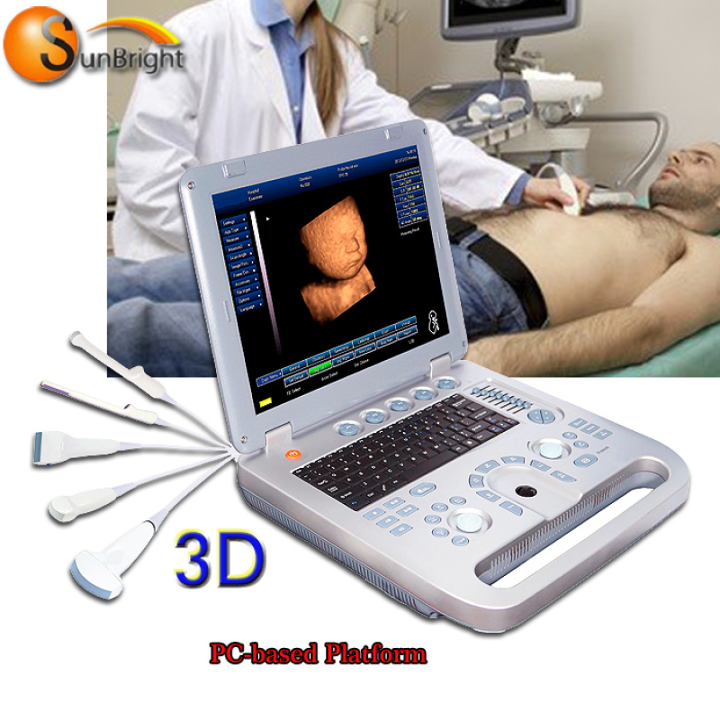 Stampante per scanner ad ultrasuoni ad ultrasuoni con trasduttore 3D ad alta definizione per umani e animali