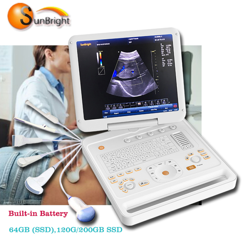 Повністю цифровий 3D/4D CW кольоровий доплерівський ультразвуковий апарат b-mode